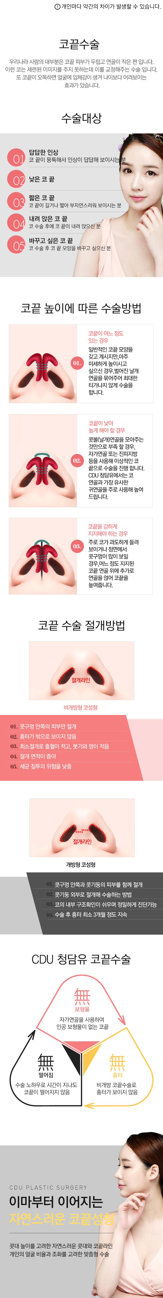 낮은코수술