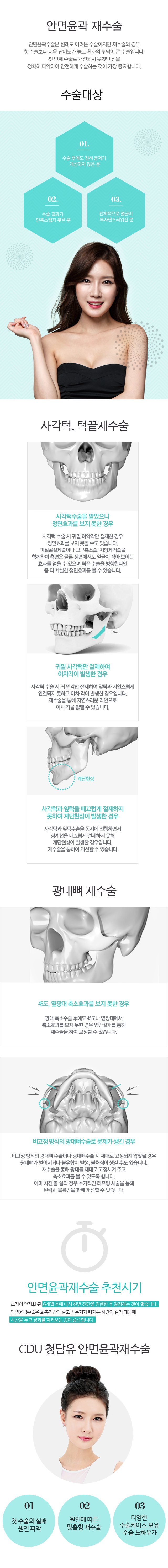 퀵광대축소술